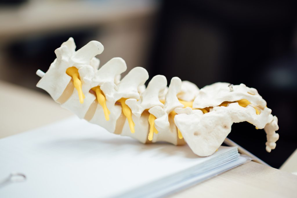 A close-up of a 3D anatomical model of the human spine, showing vertebrae and yellow nerve roots, placed on a desk