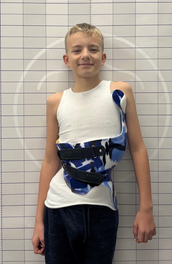 Benjamin wearing his custom-designed scoliosis brace for support and correction