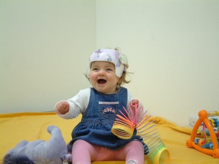 Baby smiling and playing with a toy, wearing a custom-made Locband helmet.