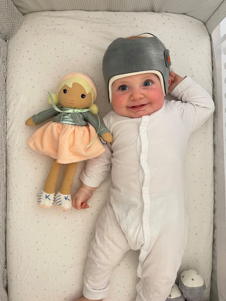 Matisse in her LOCband Lite helmet from the London Orthotic consultancy