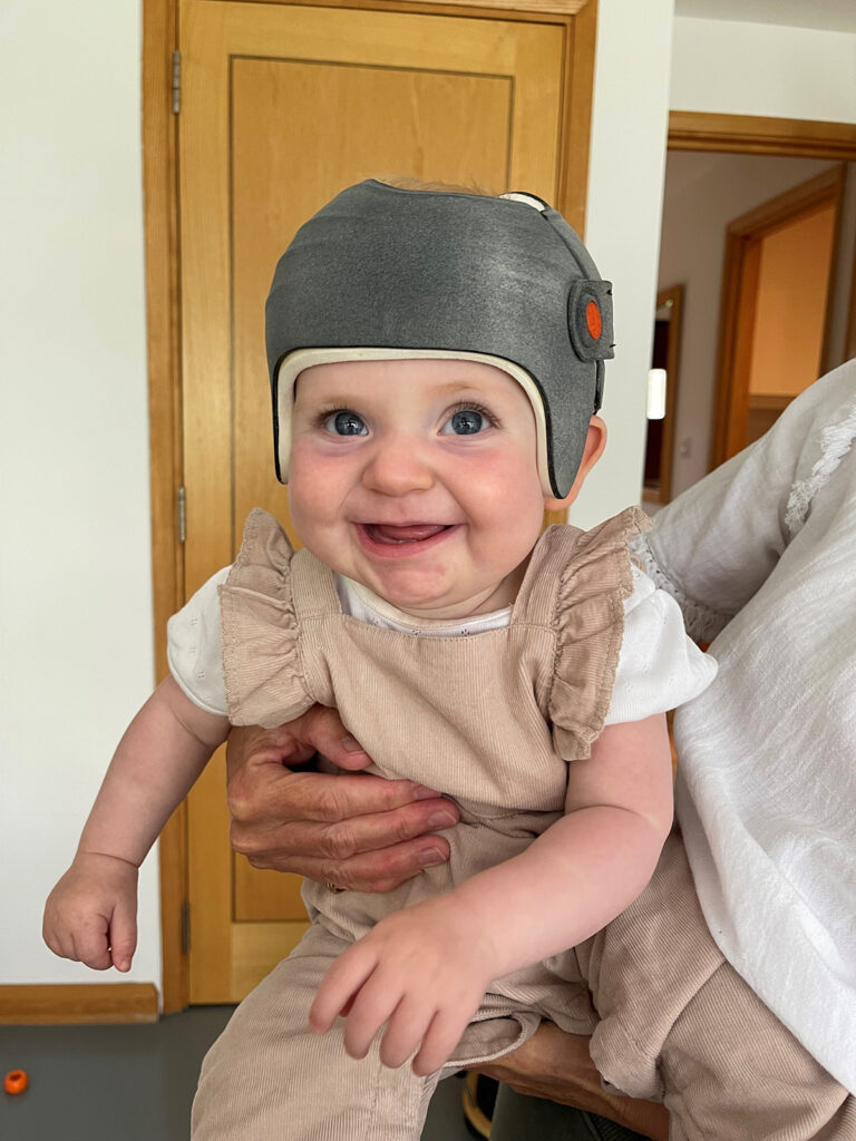 Matisse with a big smile wearing her LOCband helmet