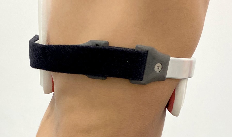 Bepsoke pectus carinatum brace with 3D printed clips