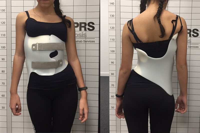 back and front of Gensingen brace