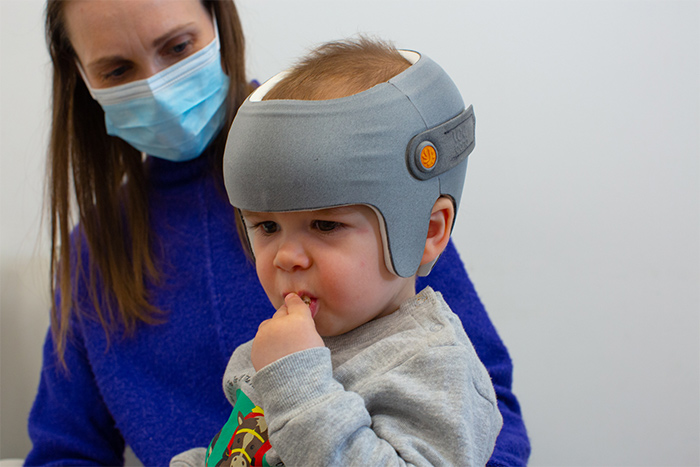 Baby during flathead syndrom fitting appointment